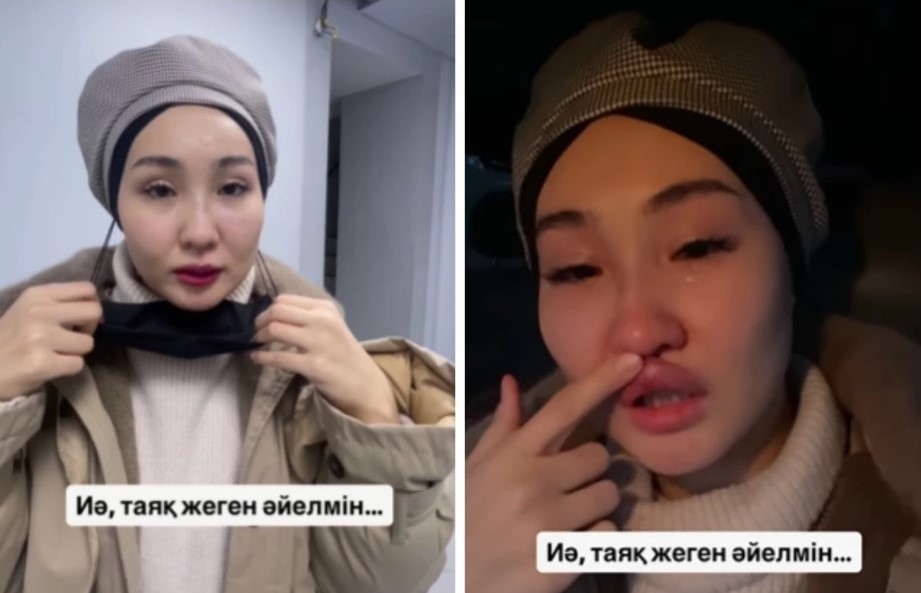 «Мұрнымнан аққан қанды бас киіммен сүрттім»: Белгілі әншінің әйелі соққыға жығылған (видео)